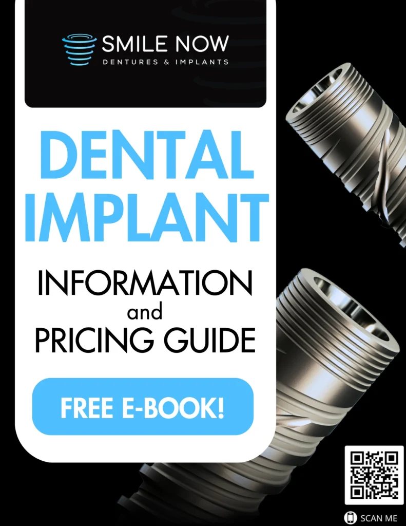 Free dental implants information and pricing guide at Smile Now Milwaukee in Milwaukee, WI