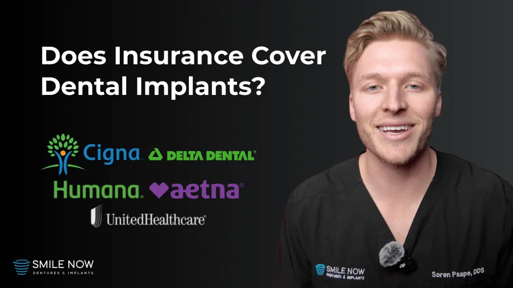 Thumbnail for a video discussing does insurance cover dental implants