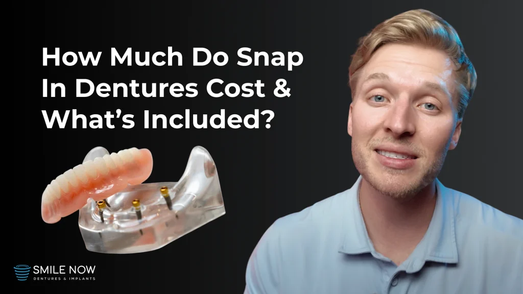 Thumbnail for a video about the Snap In Dentures Cost: A Complete Breakdown for Patients