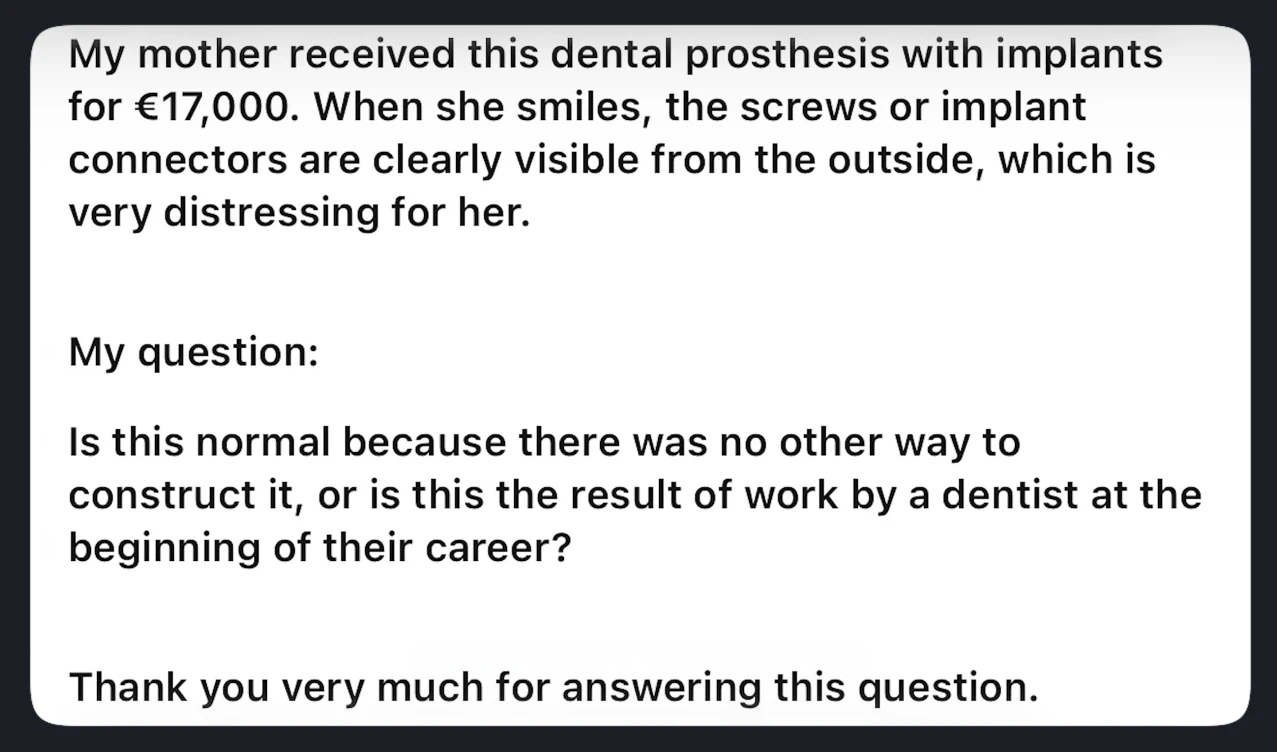 Dental implant questions: Should I be able to see the dental implants in my prosthesis when I smile?